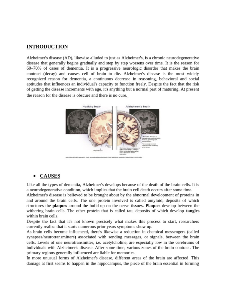 Understanding Alzheimer's Disease Stages | PDF | Alzheimer's Disease ...