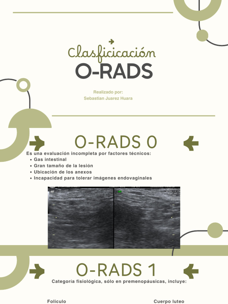 Clasificación O-RADS: Riesgo de Lesiones Ováricas | PDF | Enfermedades ...