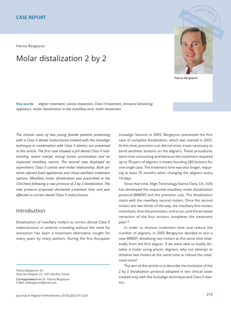 Molar Distalization with Invisalign Technique | PDF | Dental Anatomy ...