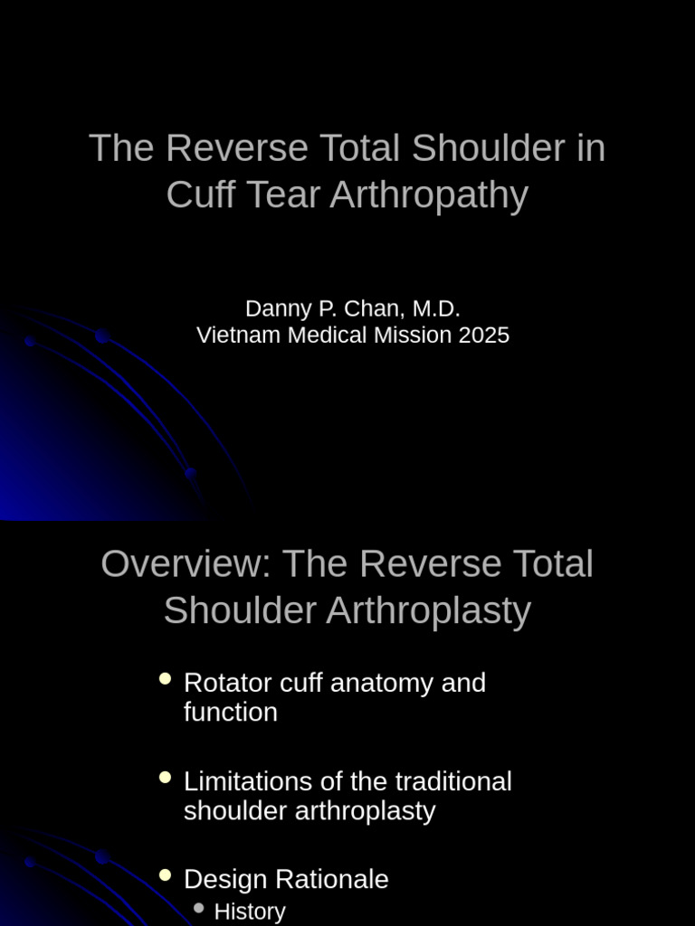 Stryker Reverse Shoulder Overview | PDF | Shoulder | Clinical Medicine