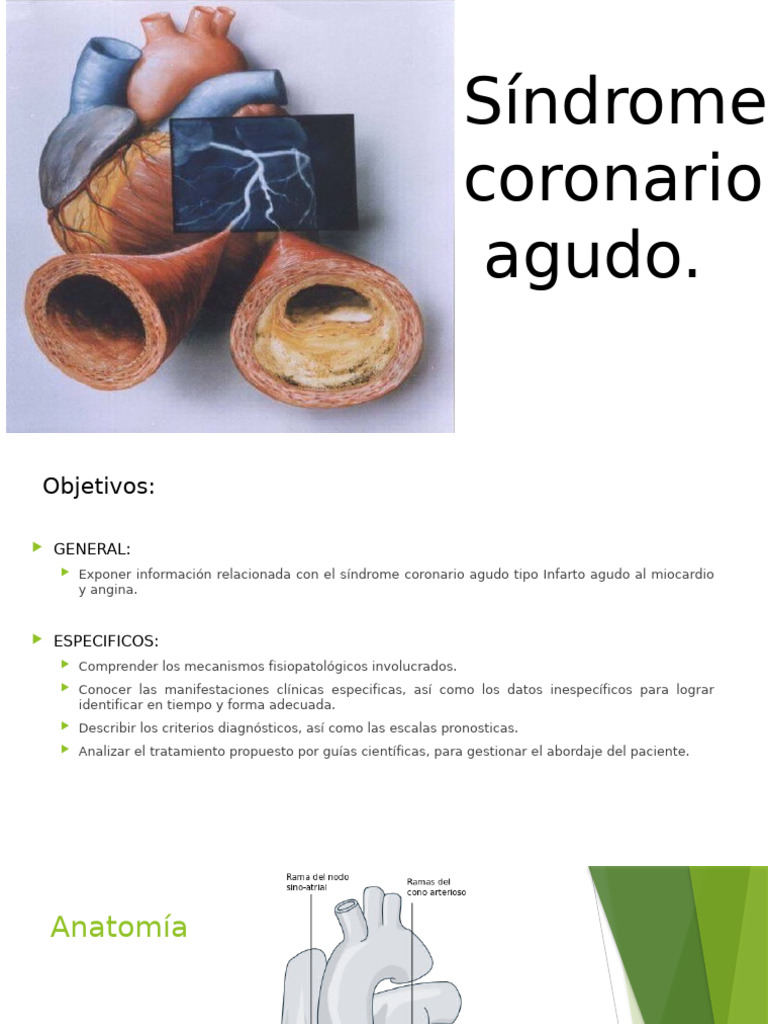 Sica Yos 2 | PDF | Infarto de miocardio | Enfermedades cardiovasculares