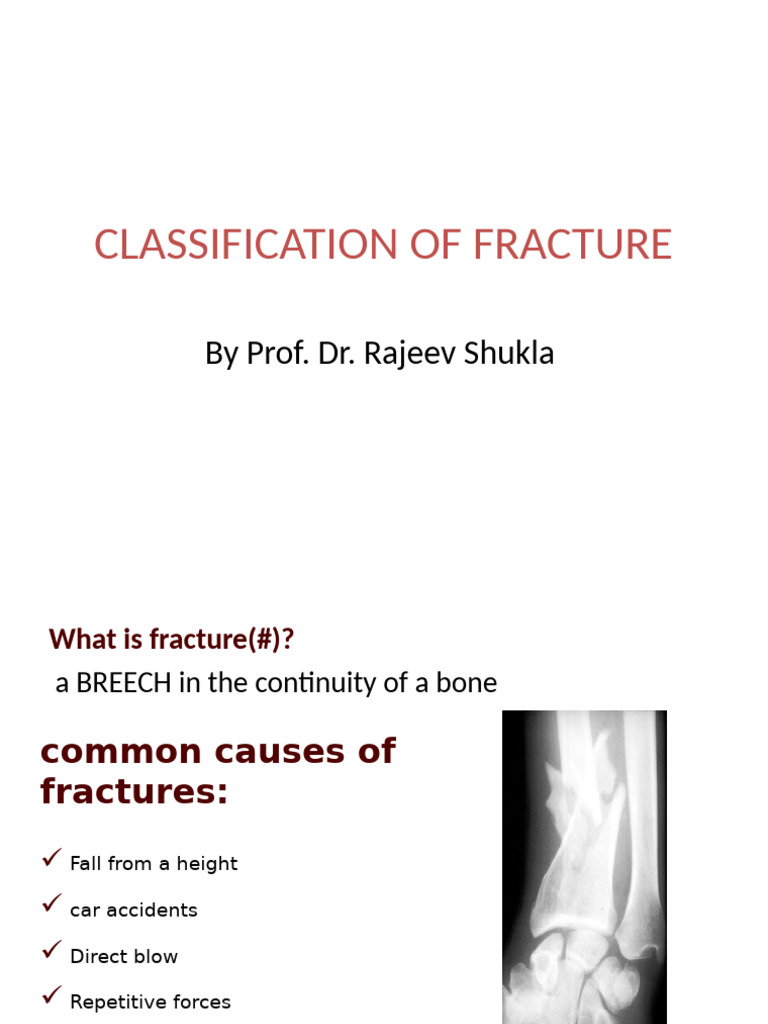 Classificationof 140310050139 Phpapp02 | PDF | Bone | Musculoskeletal ...