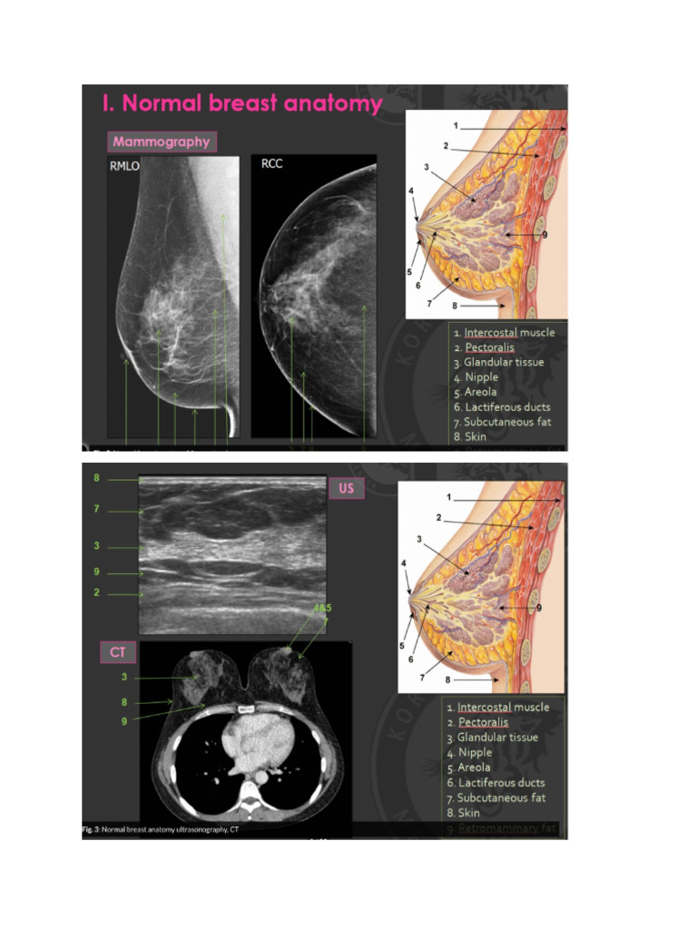Mamografi | PDF