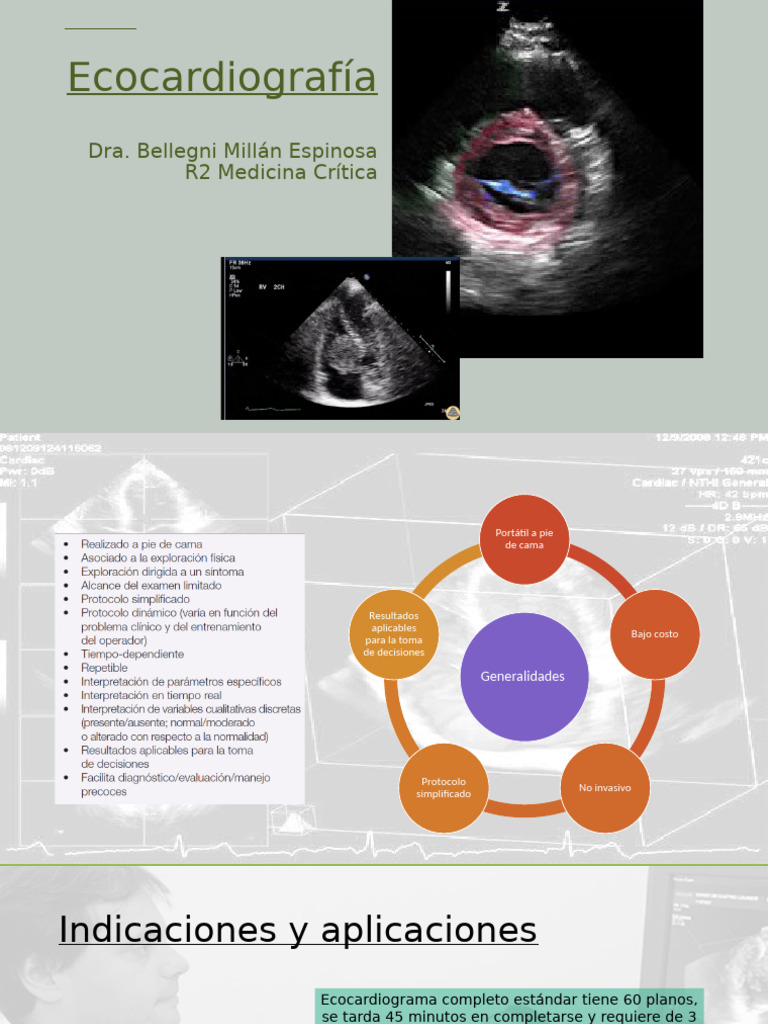 ecocardiograf-a-pdf-coraz-n-ventr-culo-coraz-n