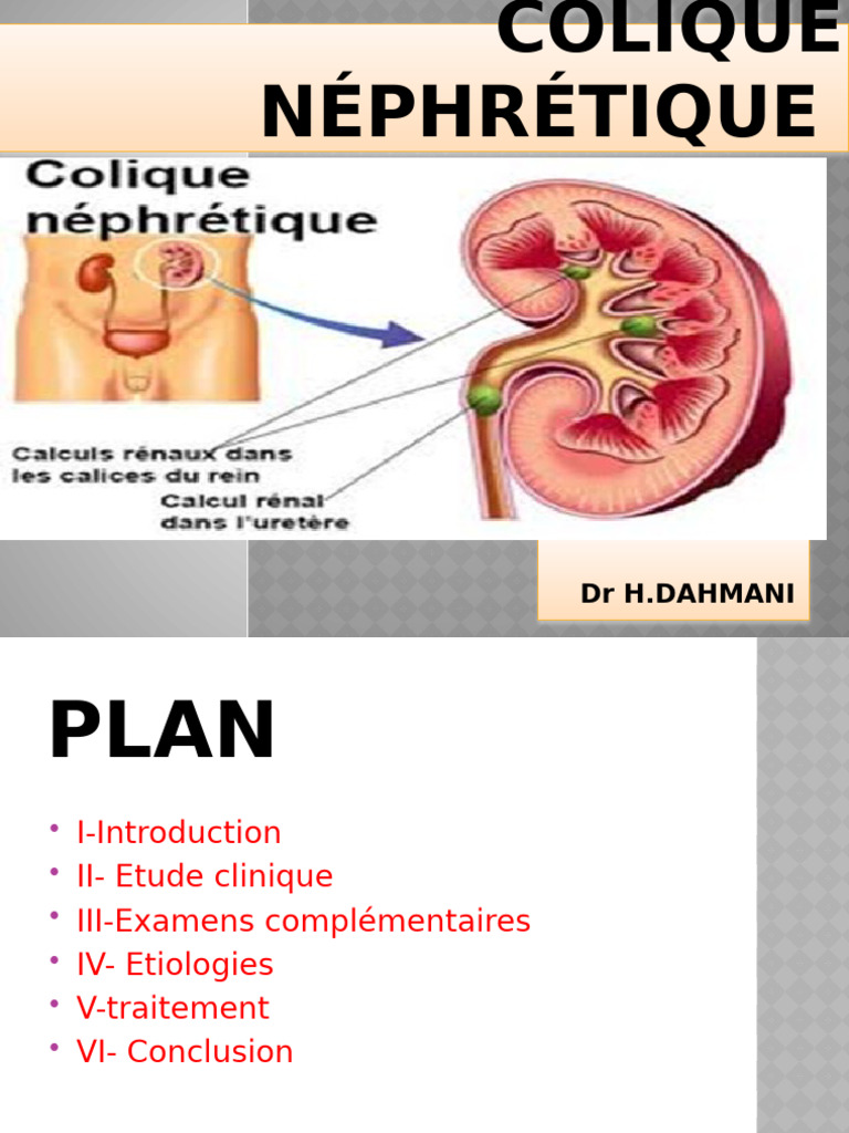 Colique néphrétique (1) PDF Médecine Médecine clinique — free download