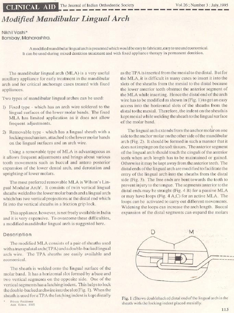 Modified Mandibular Lingual Arch | PDF