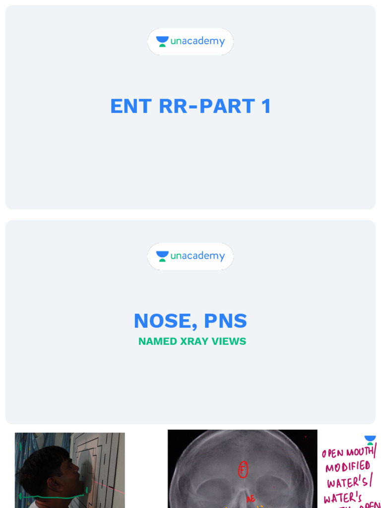 ENT Anatomy and Conditions Overview | PDF
