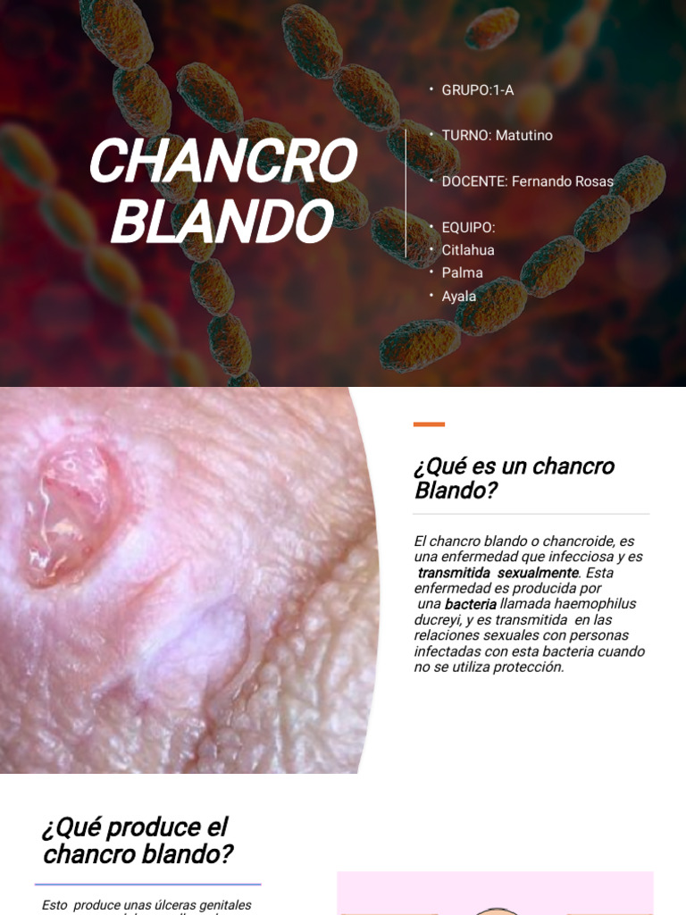 Chancro Blanda | PDF