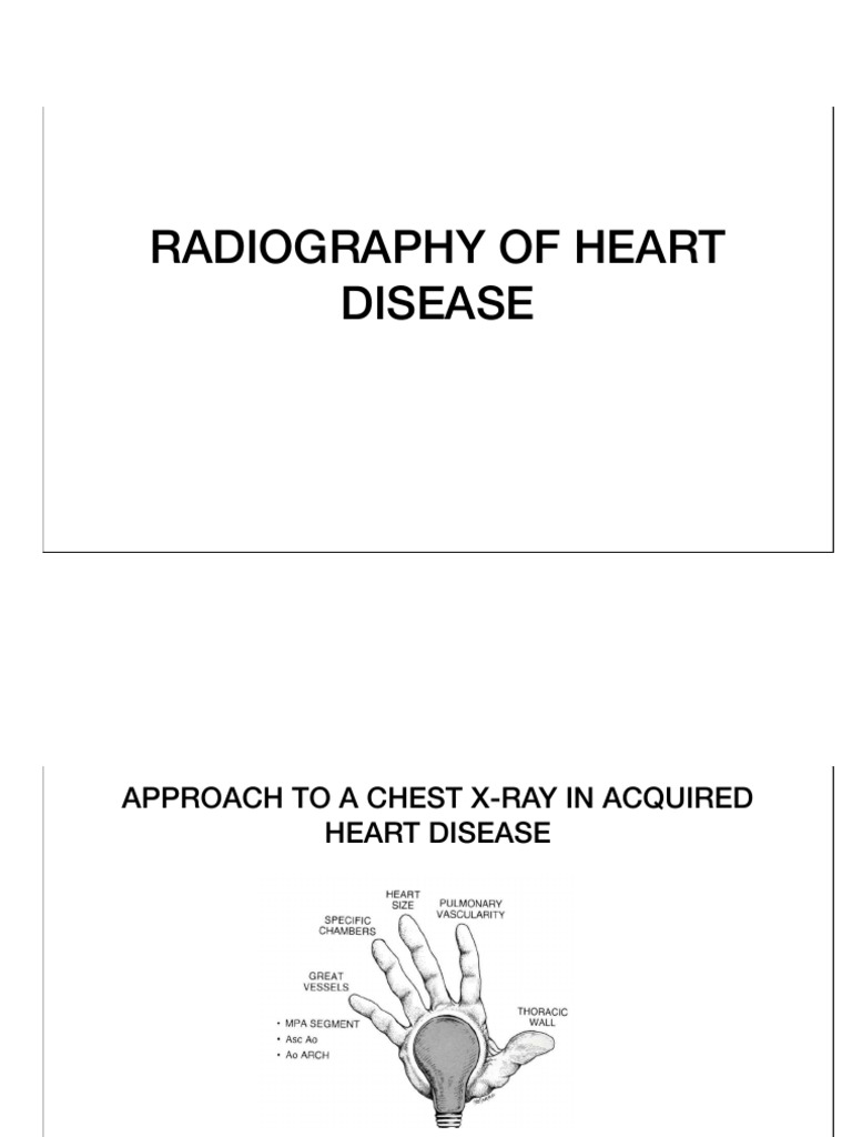 Radiology - 3. Radiography of Heart Disease (29th July 2024) DR DR ...