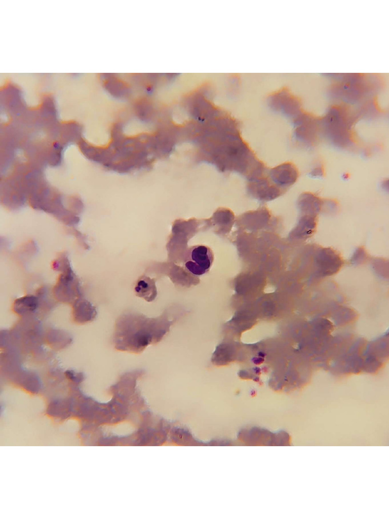Basophil | PDF