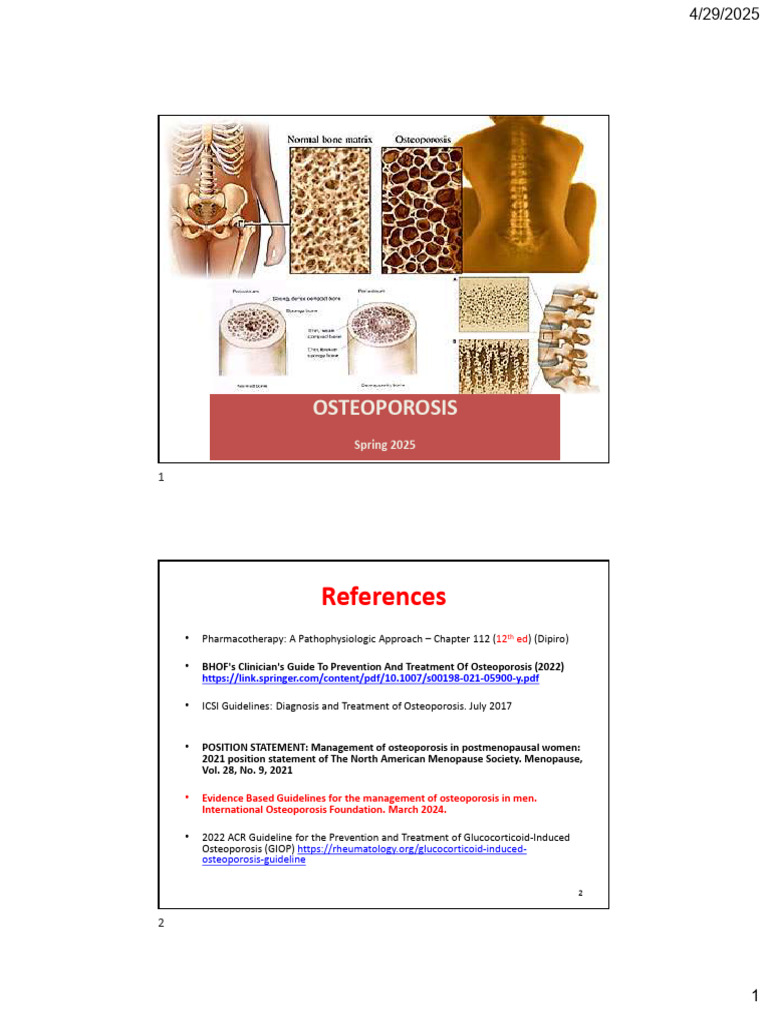 Osteoporosis Overview and Management Guide | PDF | Osteoporosis | Vitamin D