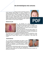 Enfermedades Dermatológicas Más Comunes