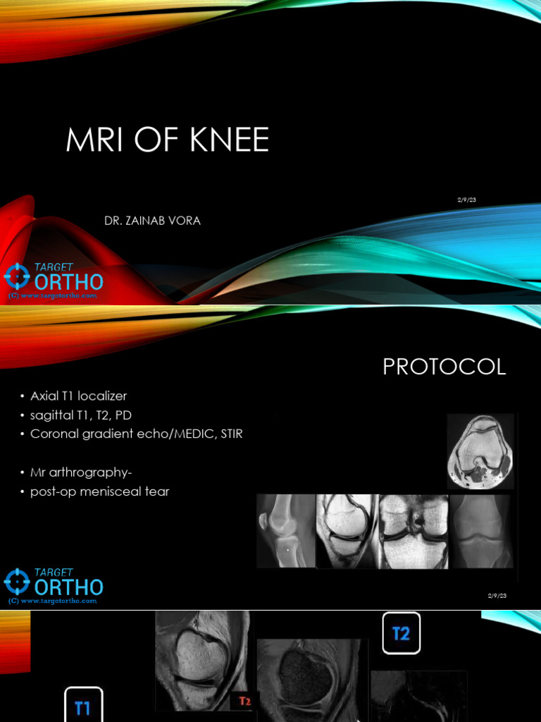 Approach To Knee MRI DrZainabpdf Lyst1726397295674 | PDF | Knee | Limbs ...
