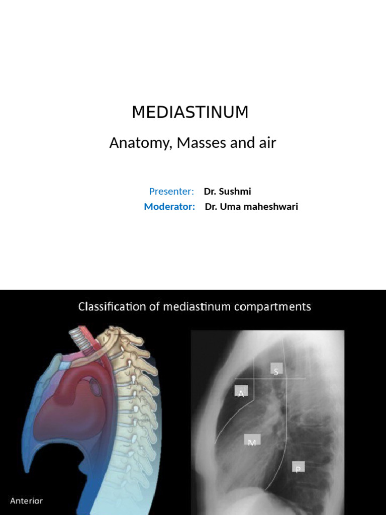 Mediastinal Masses in Radiology | PDF | Lung | Aorta