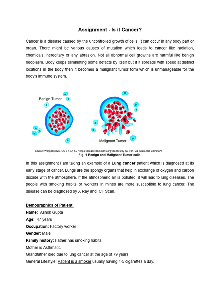 Lung Cancer Case Study: Ashok Gupta | PDF | Cancer | Lung Cancer