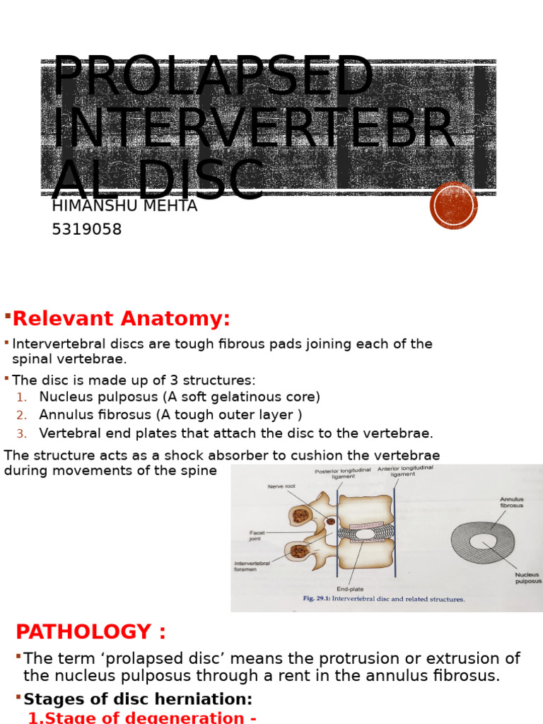 Stages of Intervertebral Disc Prolapse | PDF | Vertebral Column | Human ...