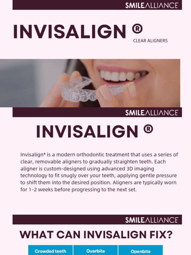Invisalign Clear Aligners Overview | PDF | Dentistry Branches