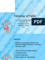 Tetralogy of Fallot