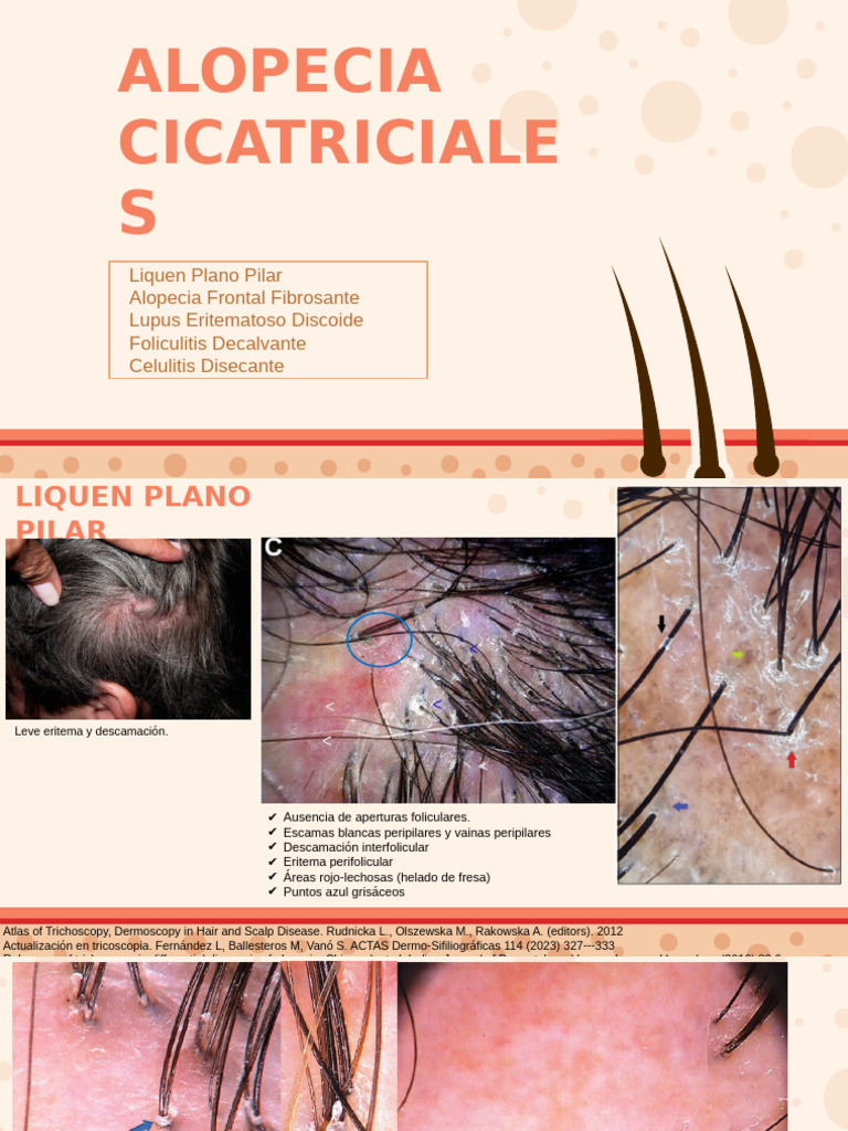 alopecia-cicatriciales-pdf-perdida-de-cabello-pelo