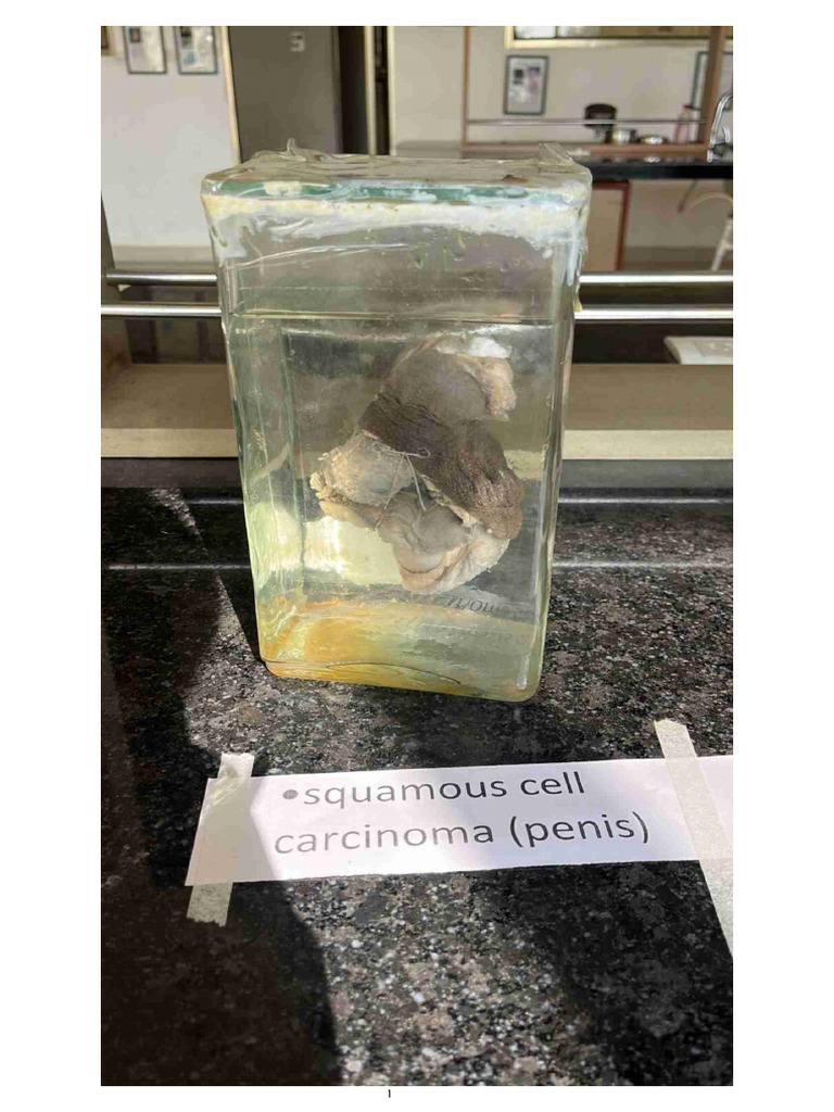U.T Practical Specimens | PDF