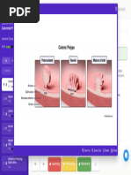 Haggitt Classification of Colorectal Polyps | PDF | Colorectal Cancer ...