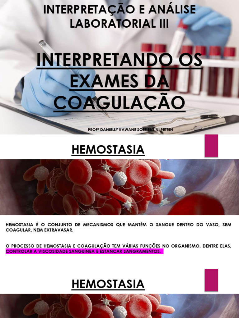 Aula 14 - Interpretação Dos Exames Da Coagulação | PDF | Coagulação ...