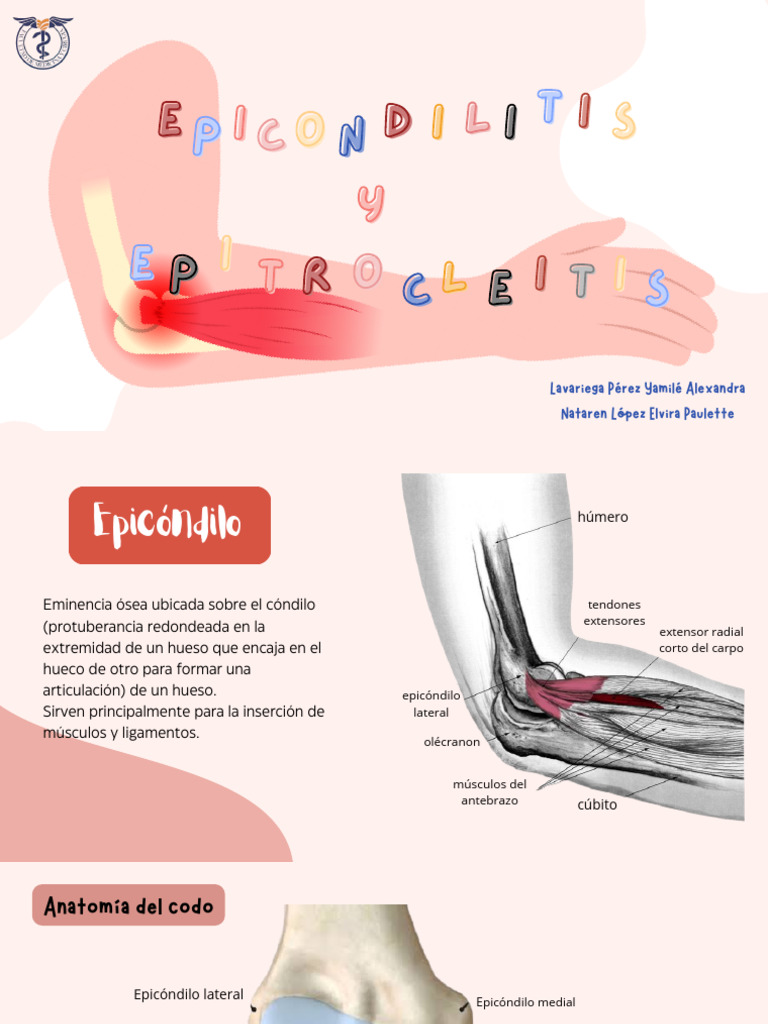 Epicondilitis y Epitrocleitis - Equipo 9 | PDF | Enfermedades y ...