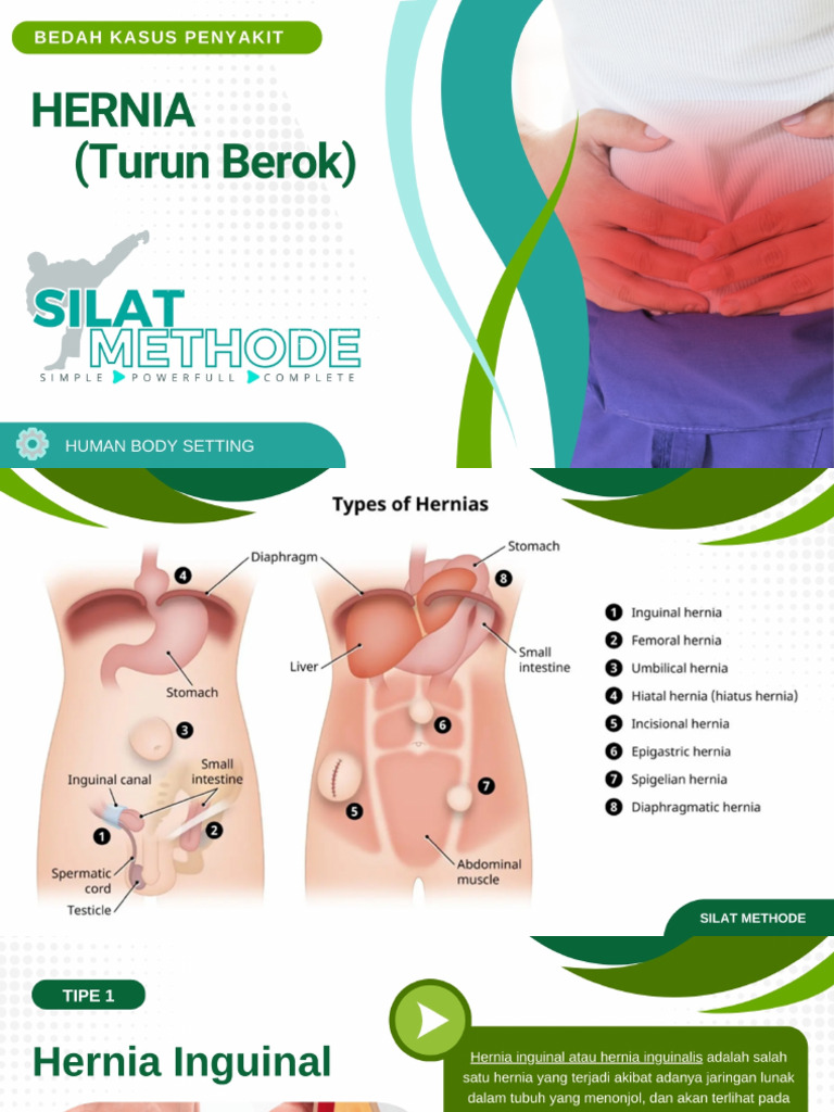 Materi Dasar HERNIA | PDF