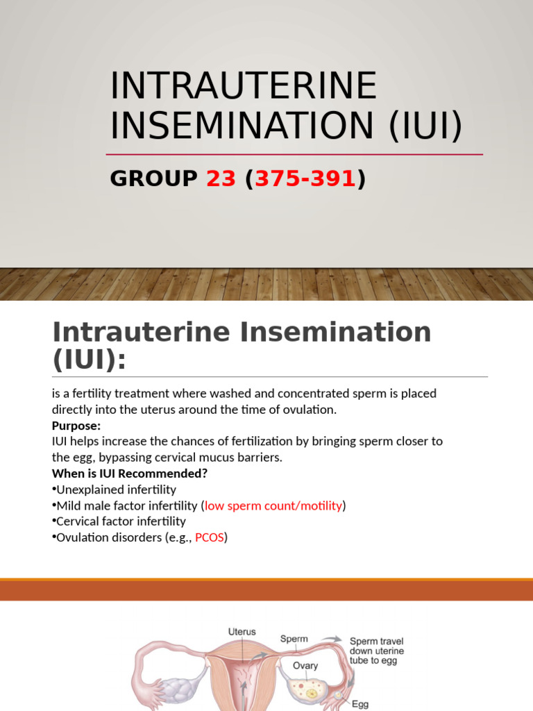 Intrauterine Insemination (IUI) Guide | PDF | Infertility | In Vitro ...