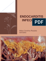 Endocarditis infecciosa guía