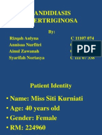 Candidiasis Intertriginosa