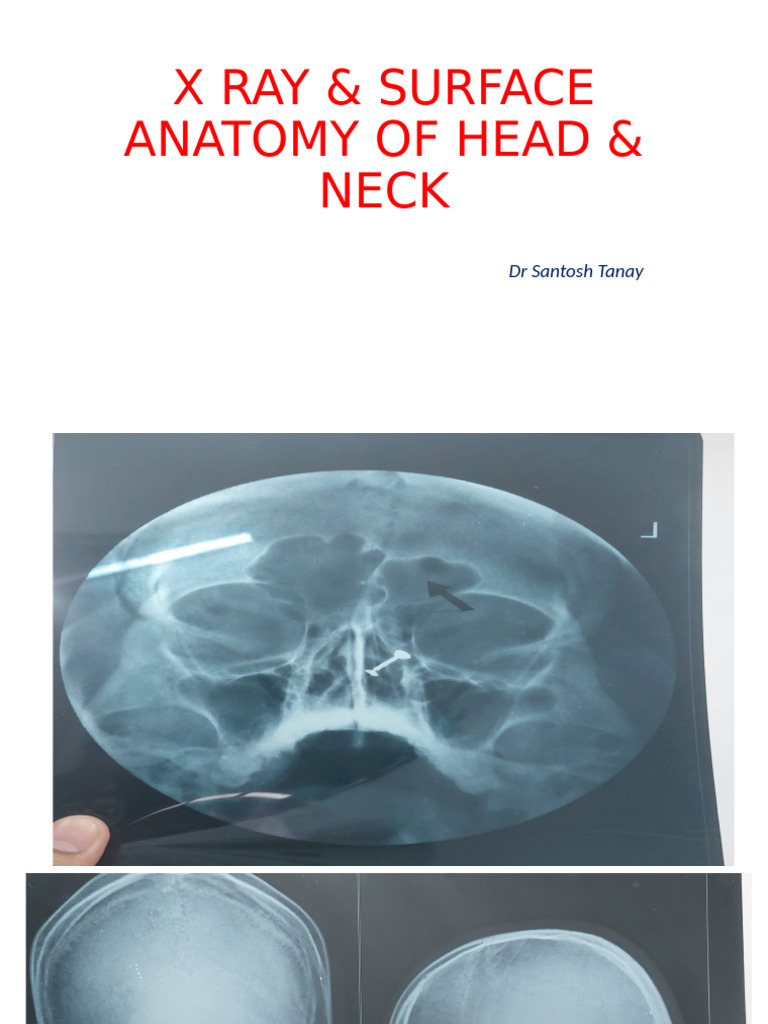 Surface Markings of Head & Neck | PDF