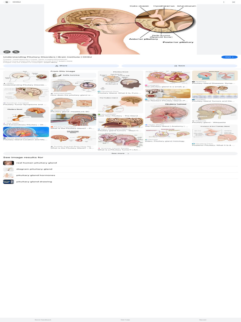 Understanding Pituitary Disorders Guide | PDF | Pituitary Gland ...