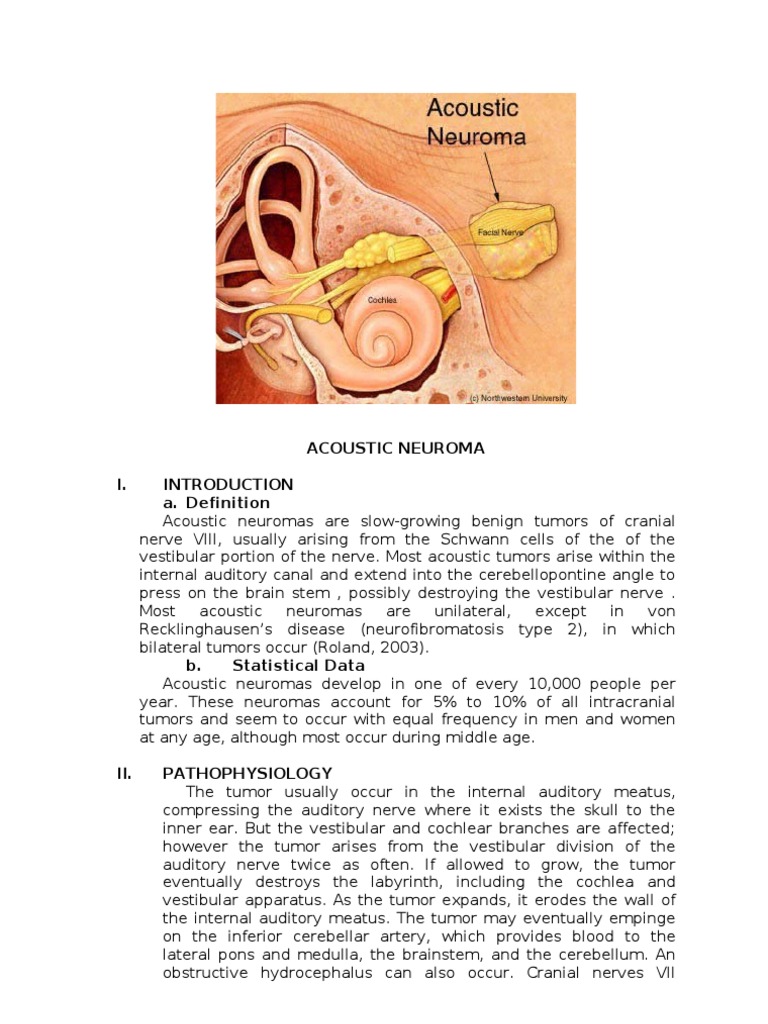 Acoustic Neuroma Resonance Imaging Radiation Therapy