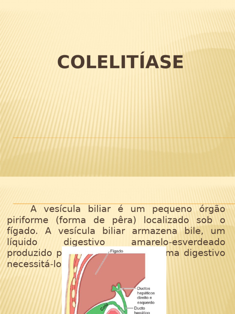 Colelitíase e Colecistite: Diagnóstico e Tratamento | PDF | Bile ...
