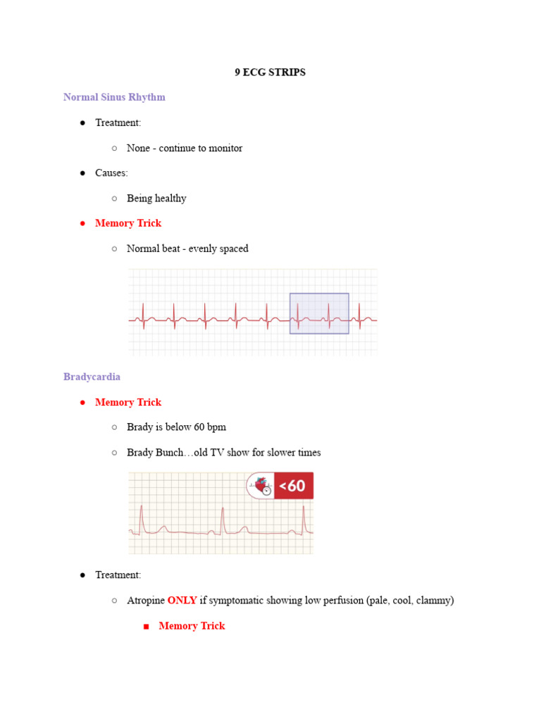 ECG Strips Overview and Treatments | PDF | Clinical Medicine | Medical ...