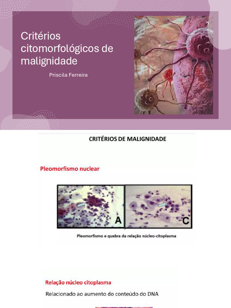 Critérios Citomorfológicos de Malignidade | PDF | Câncer | Câncer cervical