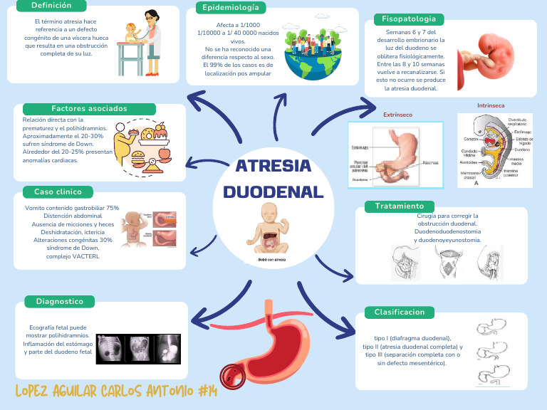 Atresia Duodenal | PDF | Síndrome de Down | Enfermedades y trastornos ...