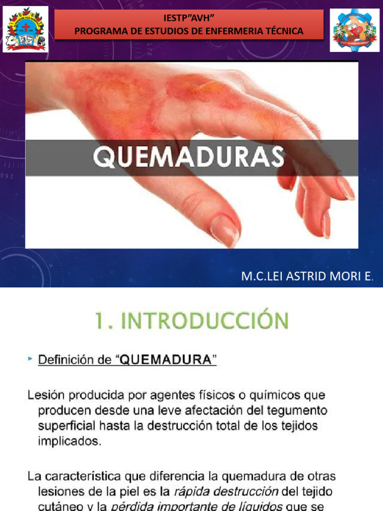 Guía de Primeros Auxilios para Quemaduras | PDF
