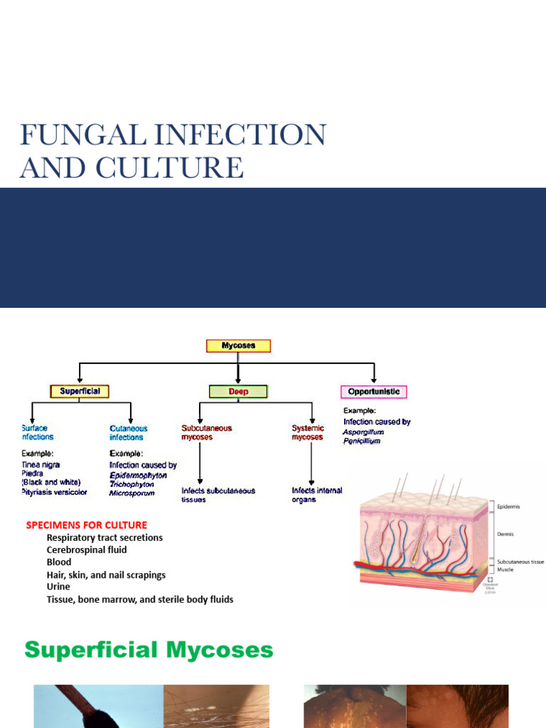 Fungal Infection and Culture PMLS2!22!23 | PDF | Staining | Immunology