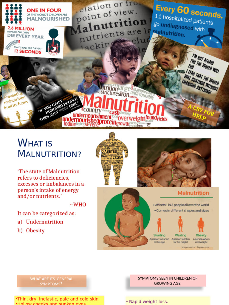Understanding Malnutrition in Children | PDF | Malnutrition | Diseases ...