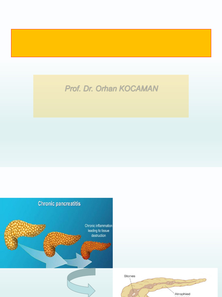 Lecture 13 - Chronic Pancreatitis | PDF | Pancreas | Gastroenterology