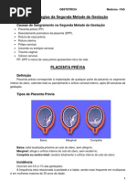 Hemorragias da Segunda Metade da Gestação - Resumo Obstetrícia Medicina