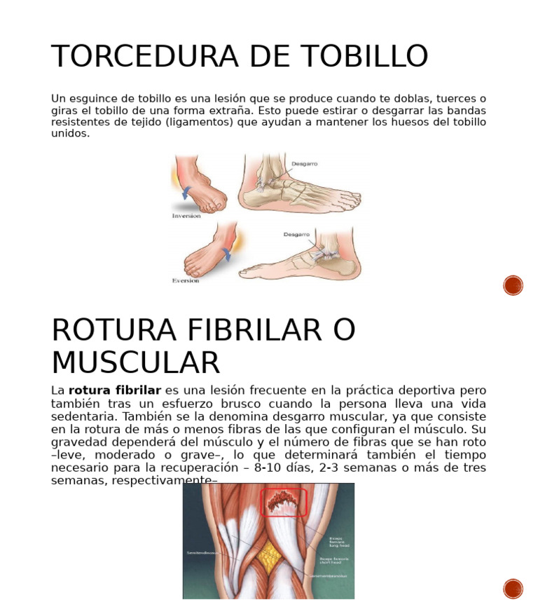 Guía sobre torcedura de tobillo | PDF