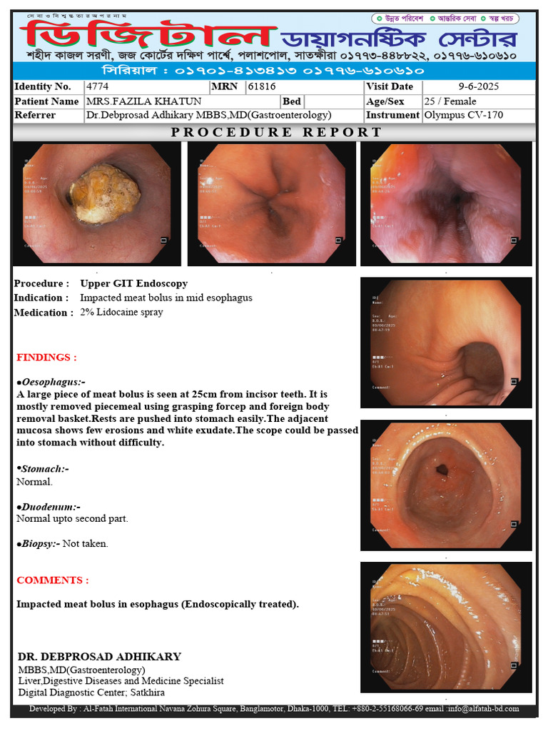 Endoscopy Report: Esophageal Meat Bolus | PDF