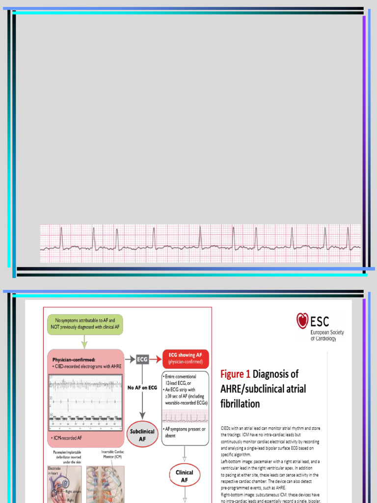 Atrial Fibrillation | PDF | Heart Failure | Heart