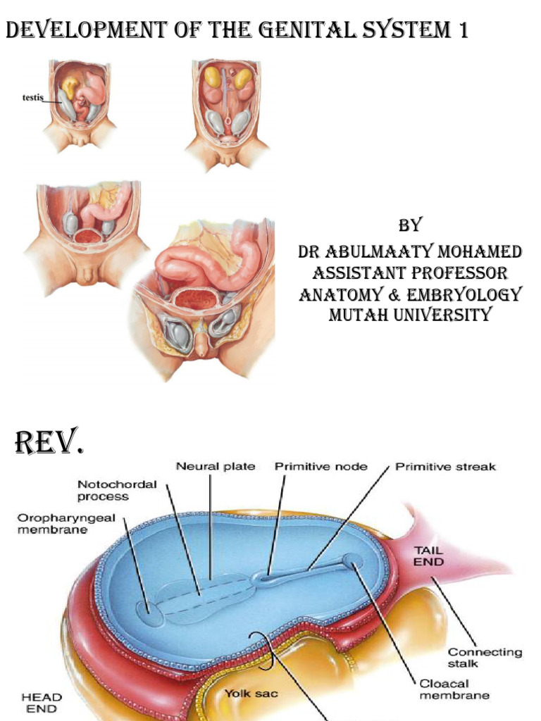 Gonadal Development and Anomalies | PDF | Testicle | Ovary