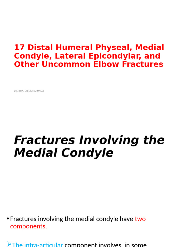 Medial Condyle Fractures in Elbow Injuries | PDF | Elbow | Injury