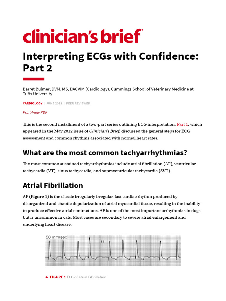 ECG Interpretation: Common Arrhythmias | PDF | Electrocardiography | Heart