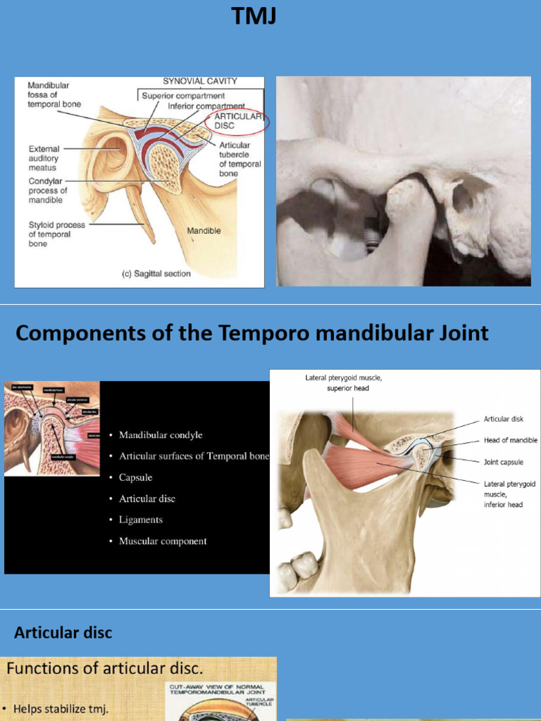 TMJ Anatomy and Components Overview | PDF